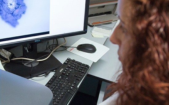 P.PORTO desenvolve diagnóstico inovador no tratamento do cancro