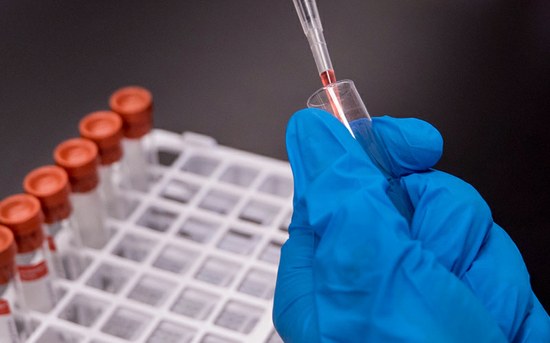 P.PORTO integra rede nacional de diagnóstico da COVID-19